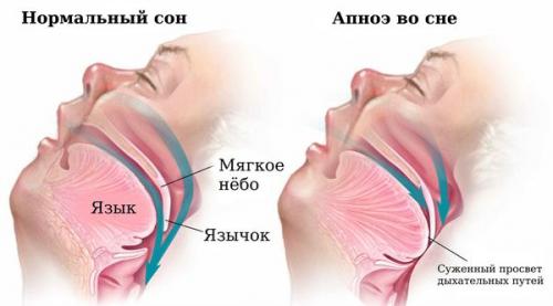 Ответы специалистов о бессоннице. Причины нарушения сна 02 Ответы специалистов о бессоннице. Причины нарушения сна 02