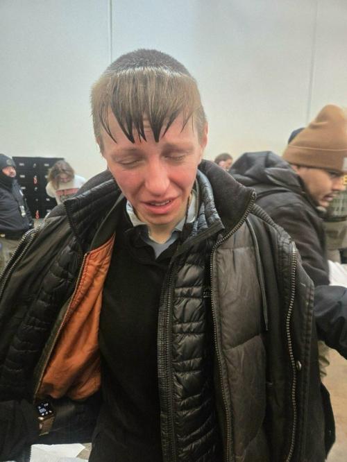 Американскому силовику откусили палец во время протестов. 01