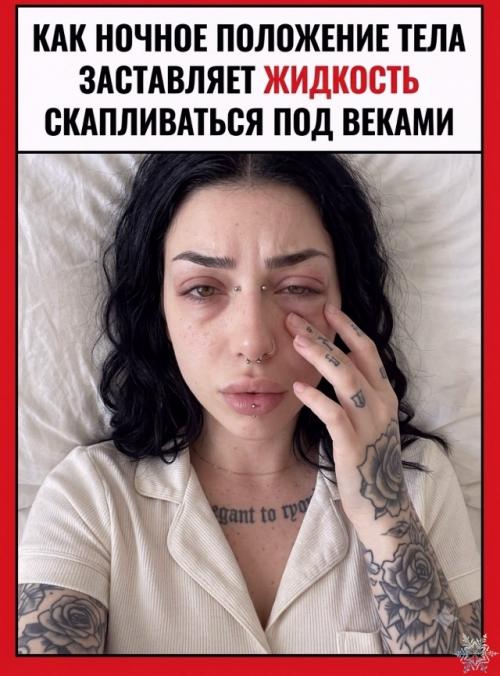 Почему после солёного отекают веки? 01