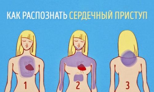 Как распознать сердечный приступ за месяц до того, как он случится? 

