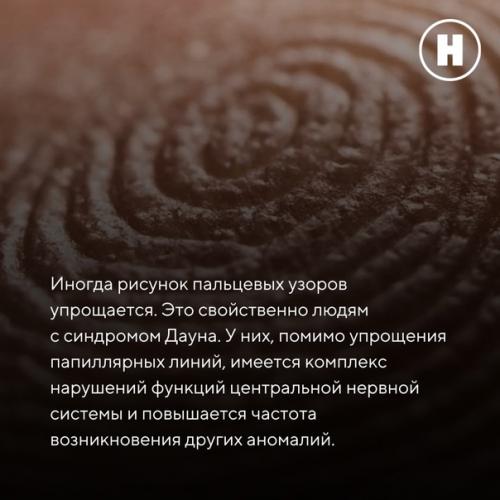 Зачем человеку нужны линии на ладонях? 06