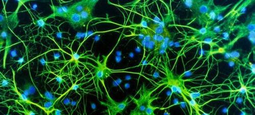 Человеческий мозг - самый сложный и малоизученный орган.