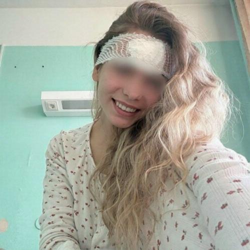 Россиянке разрезали лоб из-за выдавленного прыща. 01