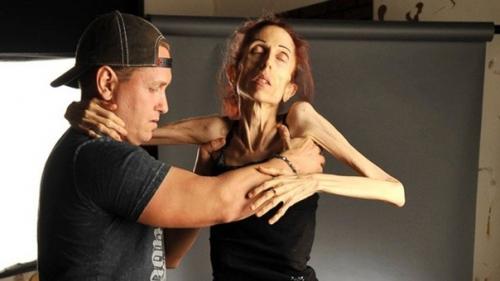 Аккуратнее с похудением! 04