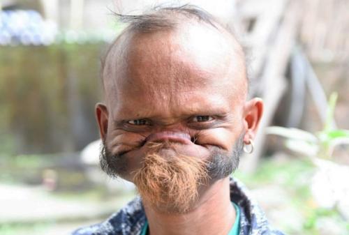 У этого человека как буд - то резиновое лицо! 01