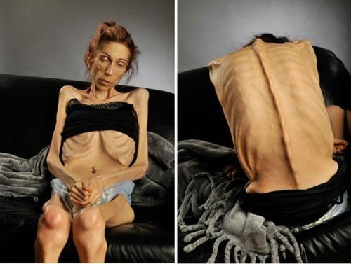 Аккуратнее с похудением! 05