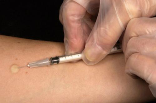 Удачная комбинация: Содружество антибиотиков победит любой вид туберкулёза.