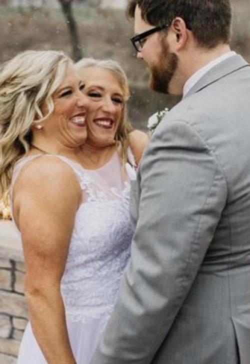 Знаменитая двухголовая девушка замуж вышла. 01