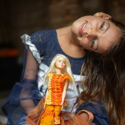 Маленькая Афшин из Пакистана в младенчестве получила тяжелую травму при падении, из-за чего её шея оказалась развернута почти на 90 градусов. 02