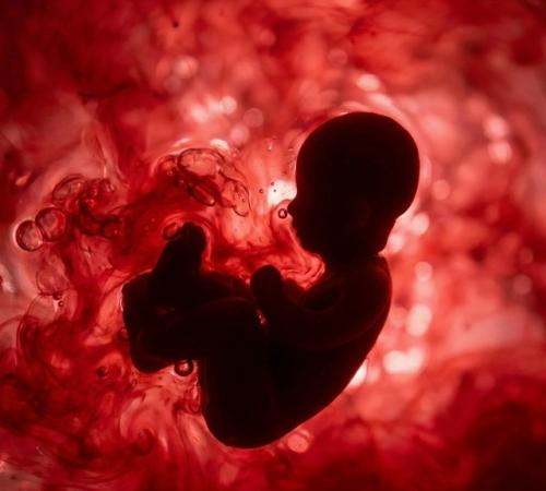 Внутриутробно кишечник у ребёнка не Пустует, но и не работает так, как после рождения. 01