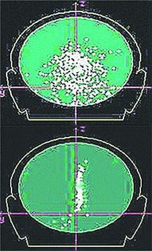 Ли у нас третий глаз есть. 01