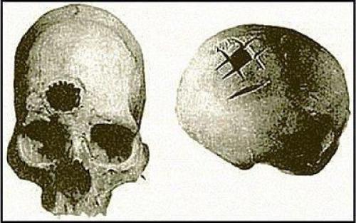 Ли у нас третий глаз есть.  