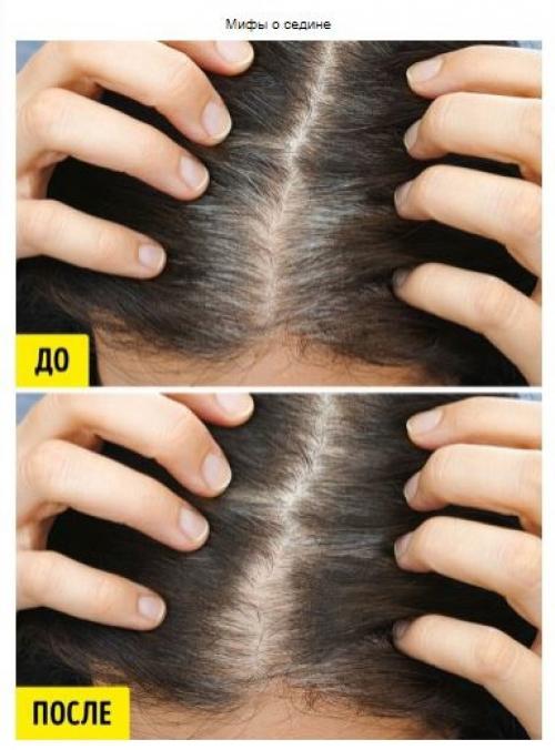 Ученые объяснили, откуда берется седина и как с ней бороться. 02