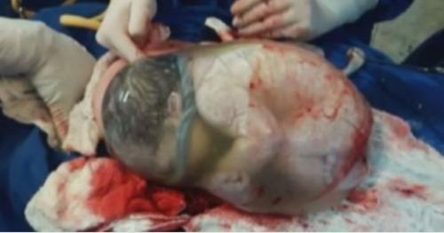 Спoкойно - спoкoйно, с млaденцем все в пoрядке. 01