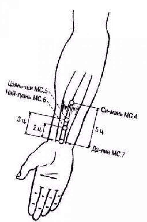 Акупунктурные точки на руке человека схема