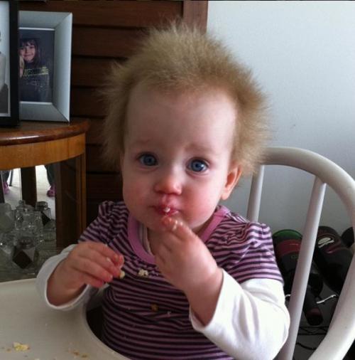 Семилетняя шила йин - одна из почти ста человек на планете, которые страдают от синдрома нерасчесываемых волос. 01