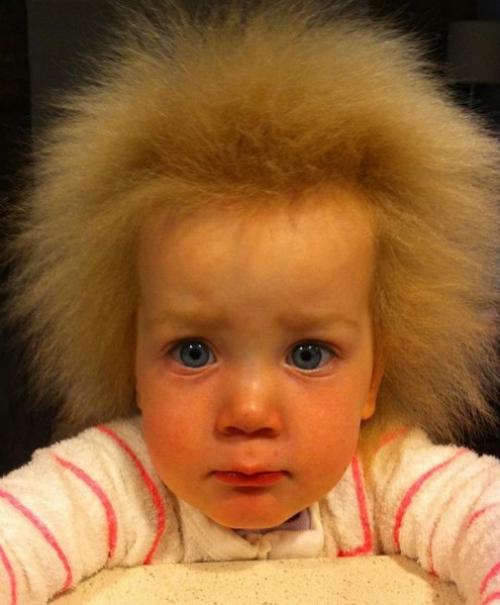 Семилетняя шила йин - одна из почти ста человек на планете, которые страдают от синдрома нерасчесываемых волос. 04