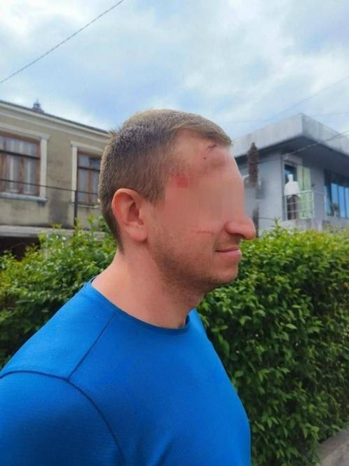 Толпа зверски избила туристов из россии в Абхазии.

