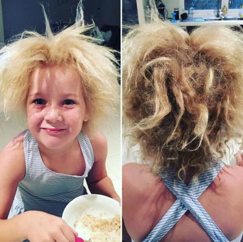 Семилетняя шила йин - одна из почти ста человек на планете, которые страдают от синдрома нерасчесываемых волос. 02