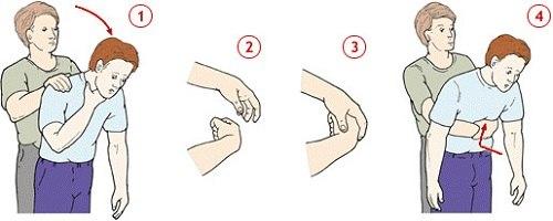 Что делать если ребенок подавился! 05 Что делать если ребенок подавился! 05