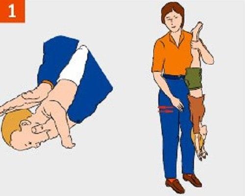 Что делать если ребенок подавился! 02 Что делать если ребенок подавился! 02