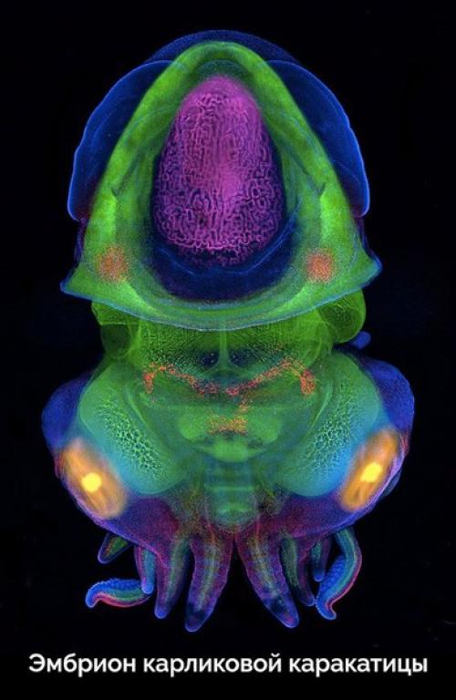 Пост любования чудесами технологий микроскопического исследования окружающего мира. 06