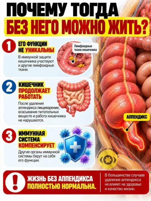 Аппендикс десятилетиями считали почти бесполезным Остатком Эволюции. 04 Аппендикс десятилетиями считали почти бесполезным Остатком Эволюции. 04
