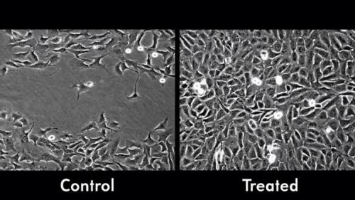 Наночастицы на 50 процентов ускоряют заживление ран. Наночастицы на 50 процентов ускоряют заживление ран.