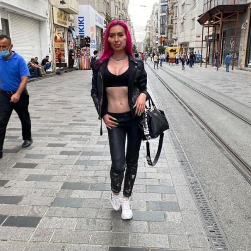 Украинка Анастасия покрищук _потратила целое состояние на новые скулы и стала звездой в Instagram. 02