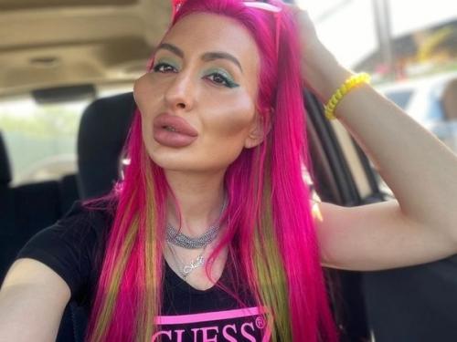 Украинка Анастасия покрищук _потратила целое состояние на новые скулы и стала звездой в Instagram. 07