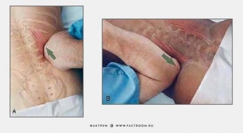 Несколько основных приёмов из практики массажа. 01