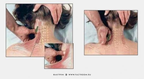 Несколько основных приёмов из практики массажа. 06