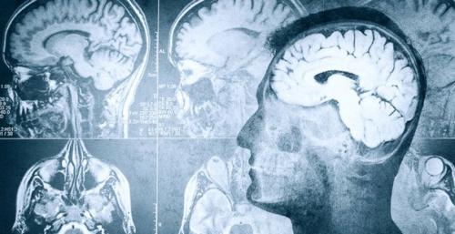 Тело в дело.  Ученые нашли способ Стирать воспоминания.