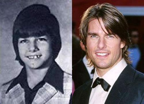 Знаменитости в детстве. 05