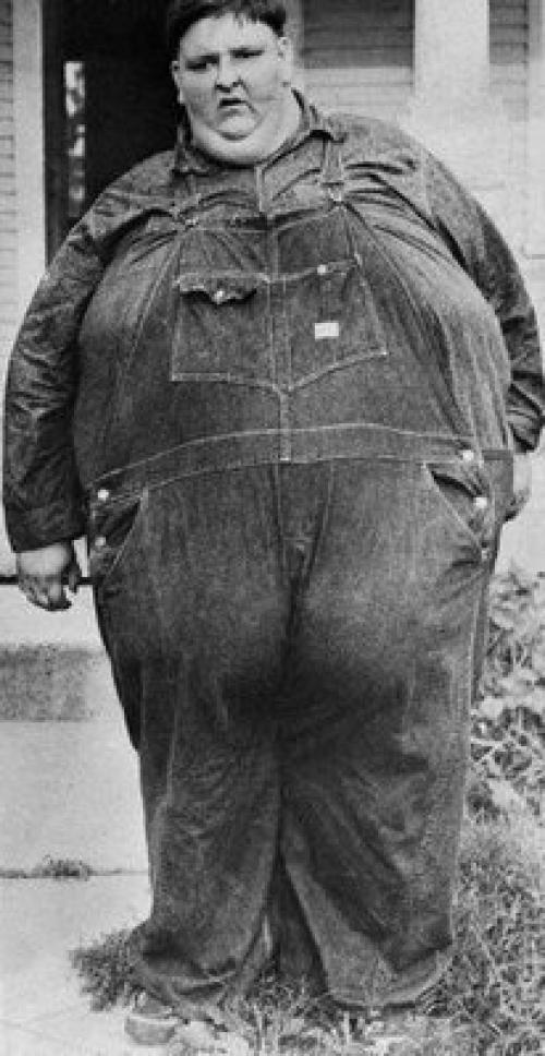 Робeрт эрл Хьюз - американец, считавшийся самым тяжелым чeловeком в иcтории медицины. 02