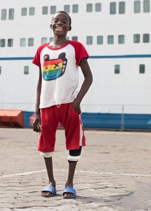 12-Летний африканский мальчик родился с очень тяжёлой деформацией ног и жил с большим трудом. 04