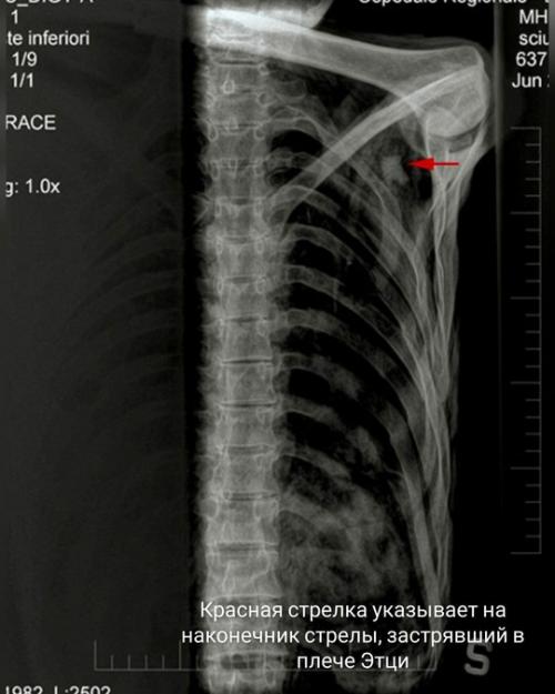 В сентябре 1991 года семейная пара из Нюрнберга, путешествуя пешком по альпийским горам, обнаружила мумию человека. 03