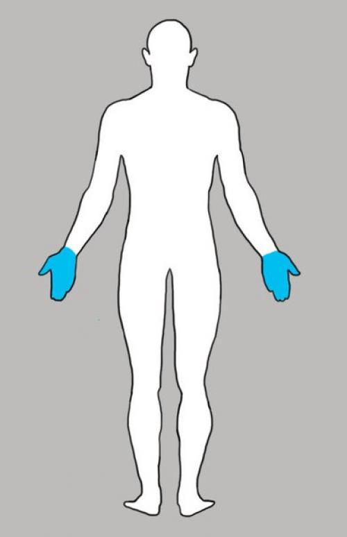 Почему у тебя что-то болит: всему есть своя причина? 06 Почему у тебя что-то болит: всему есть своя причина? 06
