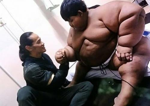 Арья пермана из Индонезии в 2016 году был признан самым толстым ребенком в мире: его вес составлял больше 190 килограммов. 01