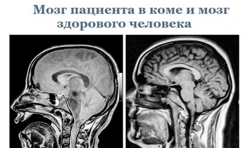 Эти cнимки paccкaжут вaм об оpгaнизмe гоpаздo прoще, чем любoй учебник пo анатoмии. 02