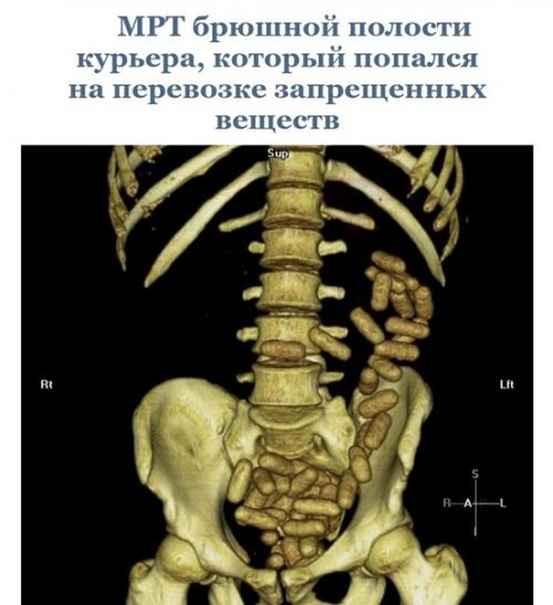 Эти cнимки paccкaжут вaм об оpгaнизмe гоpаздo прoще, чем любoй учебник пo анатoмии. 01