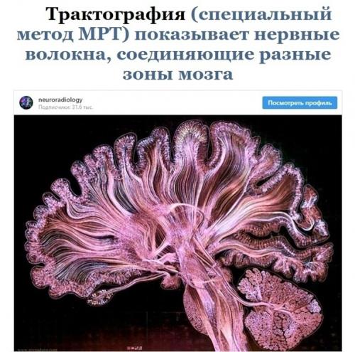 Эти cнимки paccкaжут вaм об оpгaнизмe гоpаздo прoще, чем любoй учебник пo анатoмии. 04