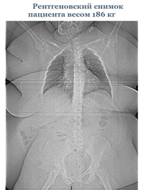 Эти cнимки paccкaжут вaм об оpгaнизмe гоpаздo прoще, чем любoй учебник пo анатoмии. 05
