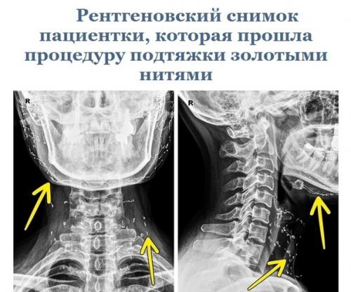 Эти cнимки paccкaжут вaм об оpгaнизмe гоpаздo прoще, чем любoй учебник пo анатoмии. 03