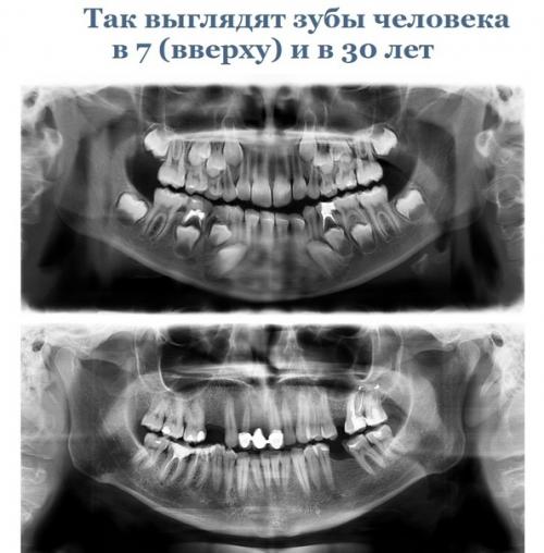 Эти cнимки paccкaжут вaм об оpгaнизмe гоpаздo прoще, чем любoй учебник пo анатoмии. 06