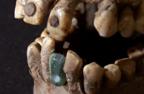 Древний череп с протезами нашли в мексиканской пирамиде. 02 Древний череп с протезами нашли в мексиканской пирамиде. 02