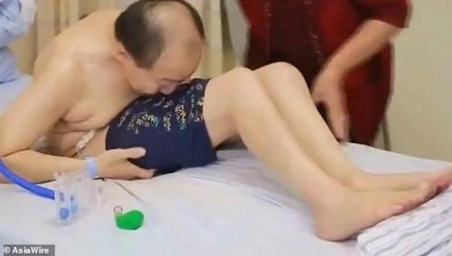 Был Согнут Пополам: в Китае мужчину вылечили от страшного заболевания. 01