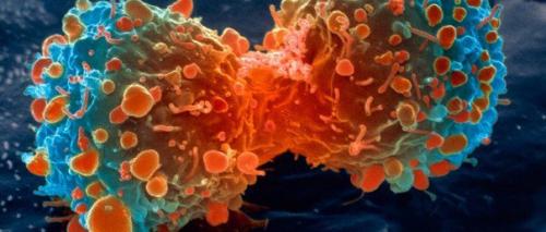 Ученые нашли способ заставить иммунную систему самостоятельно бороться с раком. Ученые нашли способ заставить иммунную систему самостоятельно бороться с раком.