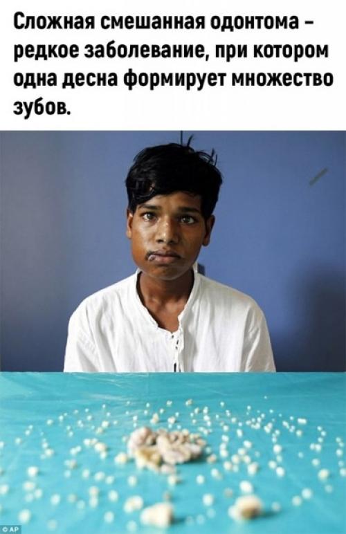 Типичная Индия. В этой Индии вечно какие то аномалии происходят. 01