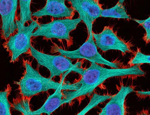Ученые предложили радикально новый подход к лечению рака: вместо того, чтобы полностью уничтожать опухоли, их решили держать под контролем.